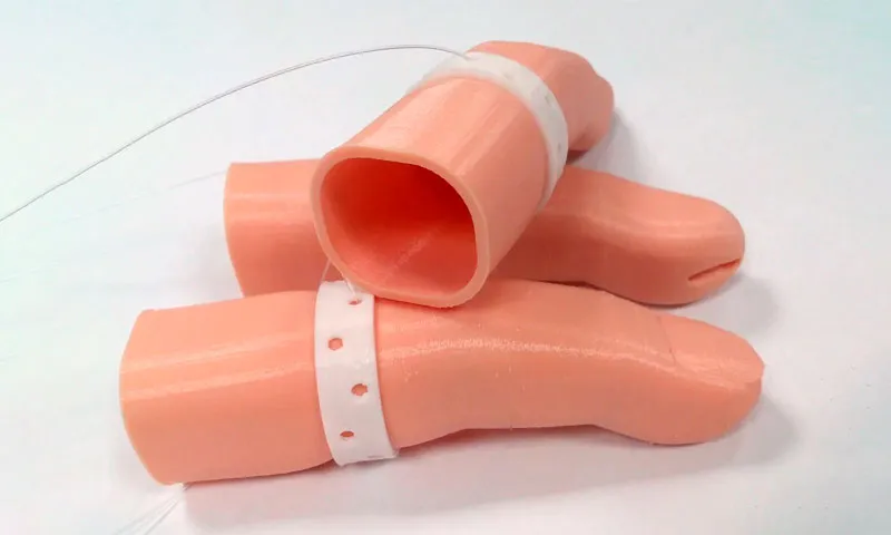 3D printed finger prostheses
